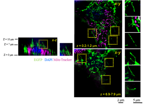 深层组织的高分辨率·高亮度分析  SeeDB2