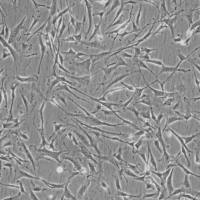 人主动脉平滑肌细胞