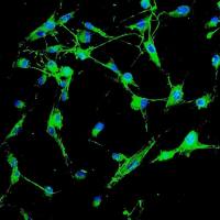 人主动脉成纤维细胞