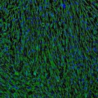 人支气管成纤维细胞