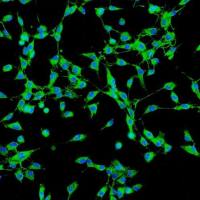 人胆囊成纤维细胞