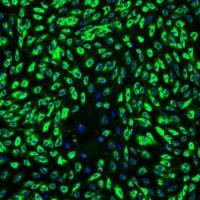 人真皮微血管内皮细胞-成人