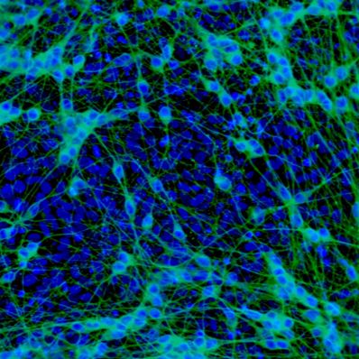 HiPSC人源性神经干细胞