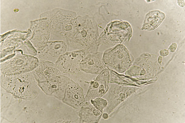 细胞发生凋亡后可观察的特征