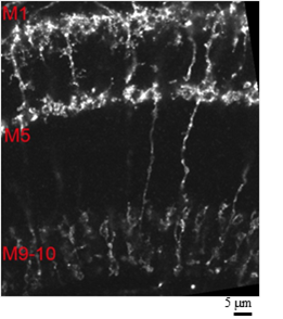 深层组织的高分辨率·高亮度分析  SeeDB2