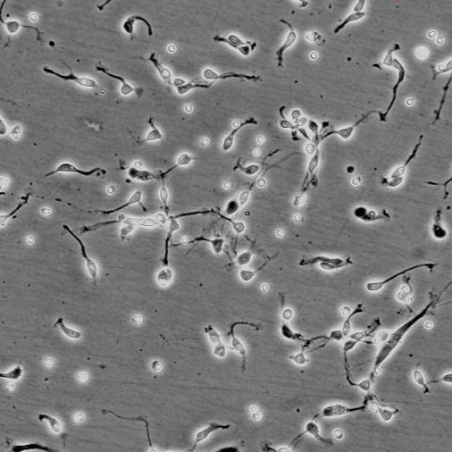 人脊髓星形胶质细胞