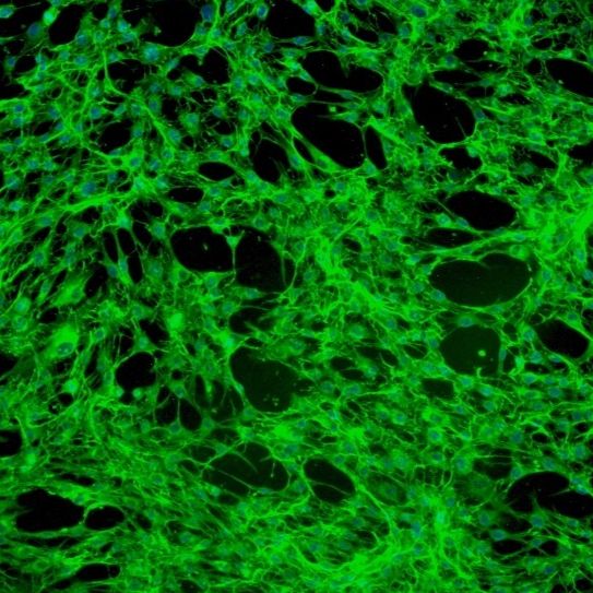 人牙龈成纤维细胞