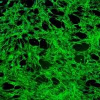 人牙龈成纤维细胞