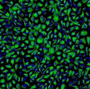 人无色素睫状上皮细胞