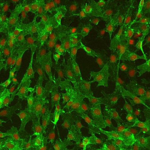 人软脑膜周细胞