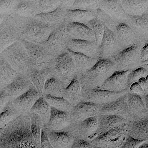 人精囊上皮细胞