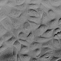 人精囊上皮细胞 HSVEpiC (Sciencell进口)