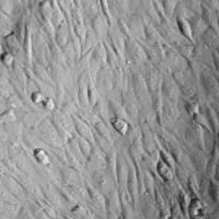 人精囊成纤维细胞HSVF (Sciencell进口)