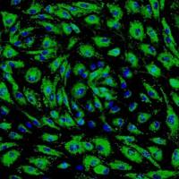 人肺微血管内皮细胞