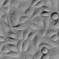 人毛囊角质细胞