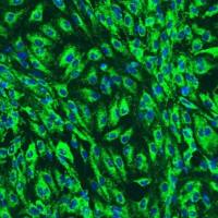 人类胰腺微血管内皮细胞