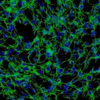 人肺动脉外膜成纤维细胞