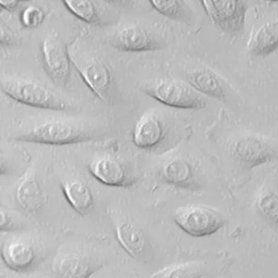 人食道微血管内皮细胞