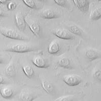 人食道微血管内皮细胞