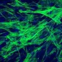 人肠平滑肌细胞 (Sciencell进口)
