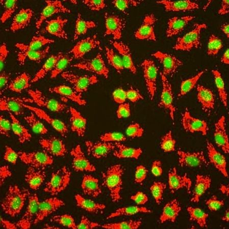 人脐静脉内皮细胞(Sciencell进口)