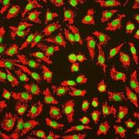 人脐静脉内皮细胞（Sciencell进口）
