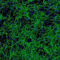 人毛囊外根鞘细胞