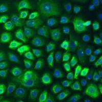 人表皮角质细胞-成人(Sciencell进口)