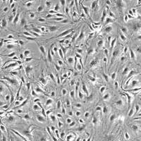 人脉络丛内皮细胞