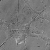 人星形胶质细胞--脑干