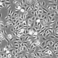 人小气道上皮细胞