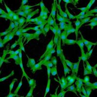 人肺间充质干细胞