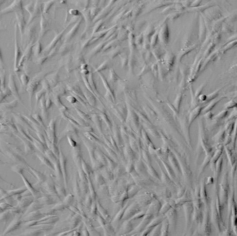 人卵巢成纤维细胞