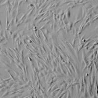 人卵巢成纤维细胞