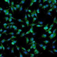 人脐带间充质干细胞