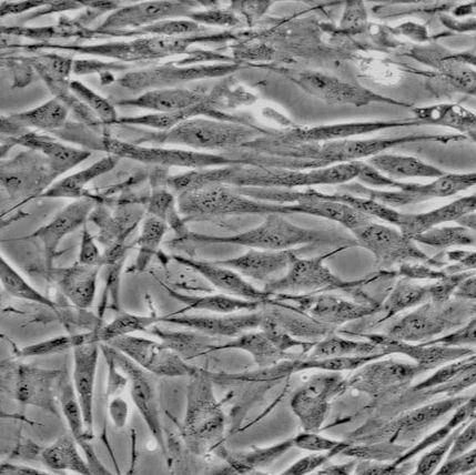 人前脂肪细胞--皮下（Sciencell进口）