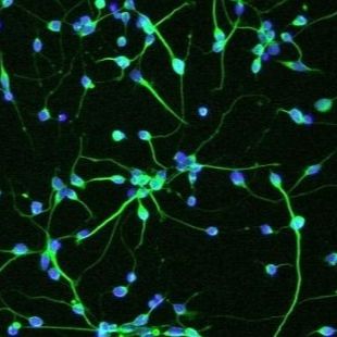 人少突胶质前体细胞 (Sciencell进口)