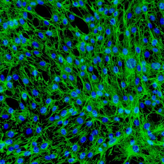 人真皮成纤维细胞--新生