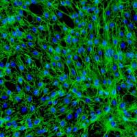 人真皮成纤维细胞-新生 HDF-n (Sciencell进口)