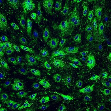 人子宫内膜微血管内皮细胞