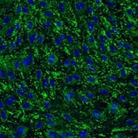 HCerMEC人子宫颈微血管内皮细胞