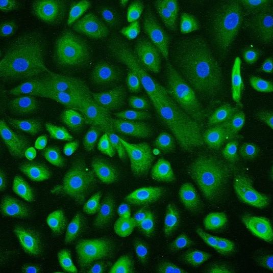 人角膜上皮细胞