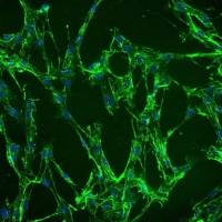 人绒毛间充质成纤维细胞