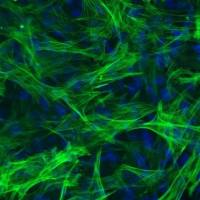 人食道平滑肌细胞