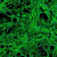 人心包成纤维细胞