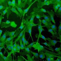 人子宫肌层的平滑肌细胞