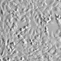 人绒毛膜间充质基质细胞 HCMSC (Sciencell进口)