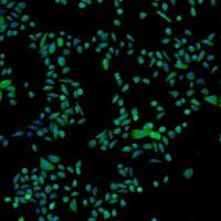 人表皮角质细胞--胎儿