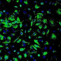 人肾小球内皮细胞