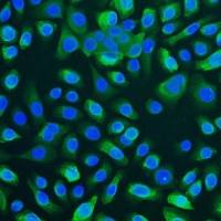 人气管上皮细胞 (Sciencell进口)